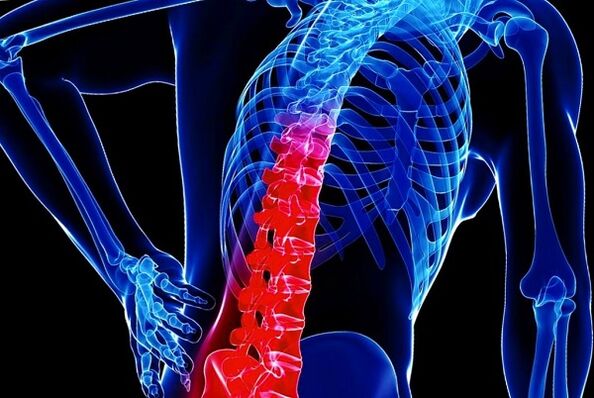 The reasons for the development of thoracic osteochondrosis