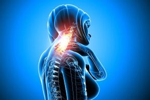 osteochondrosis in the cervical spine